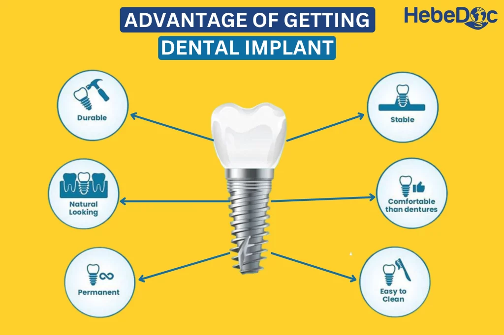 ADVANTAGE OF GETTING DENTAL IMPLANT