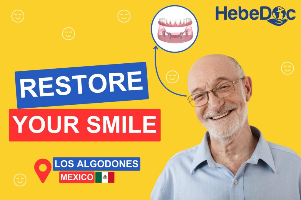 Dental implants in Los Algodones Mexico