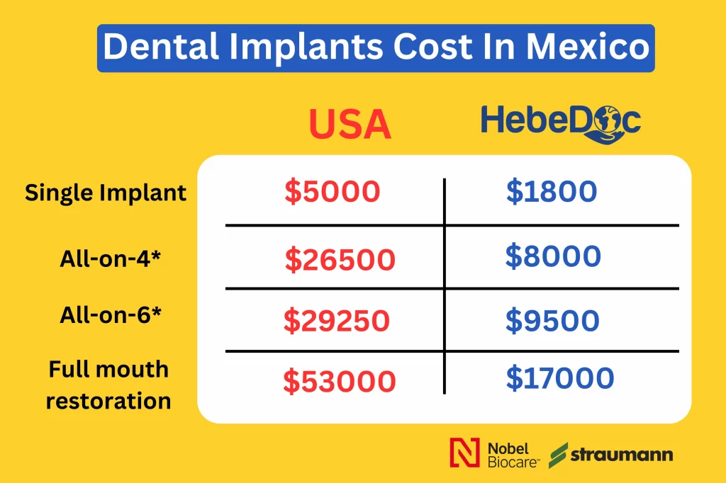 dental implants cost in mexico