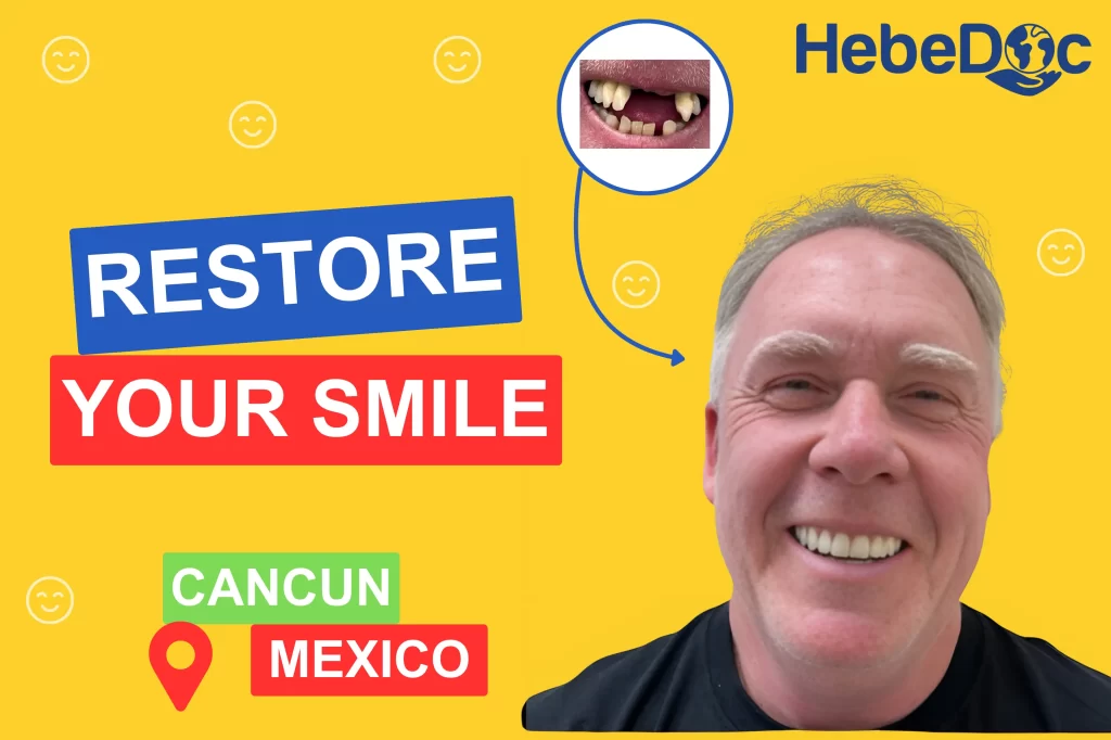 dental implants in cancun mexico