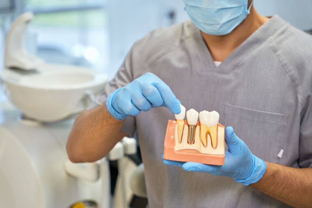 Dental Implants Types, Procedures, and How They Work