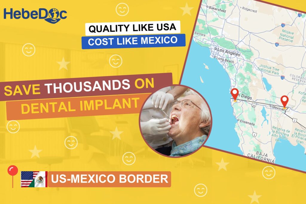 Dental implant in usa-mexico border area