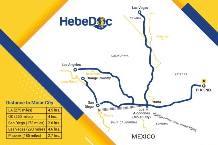 Direction to Los Algodones from USA for getting dental implant.