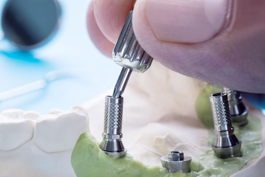 How Should I Care for My Temporary Dental Crown