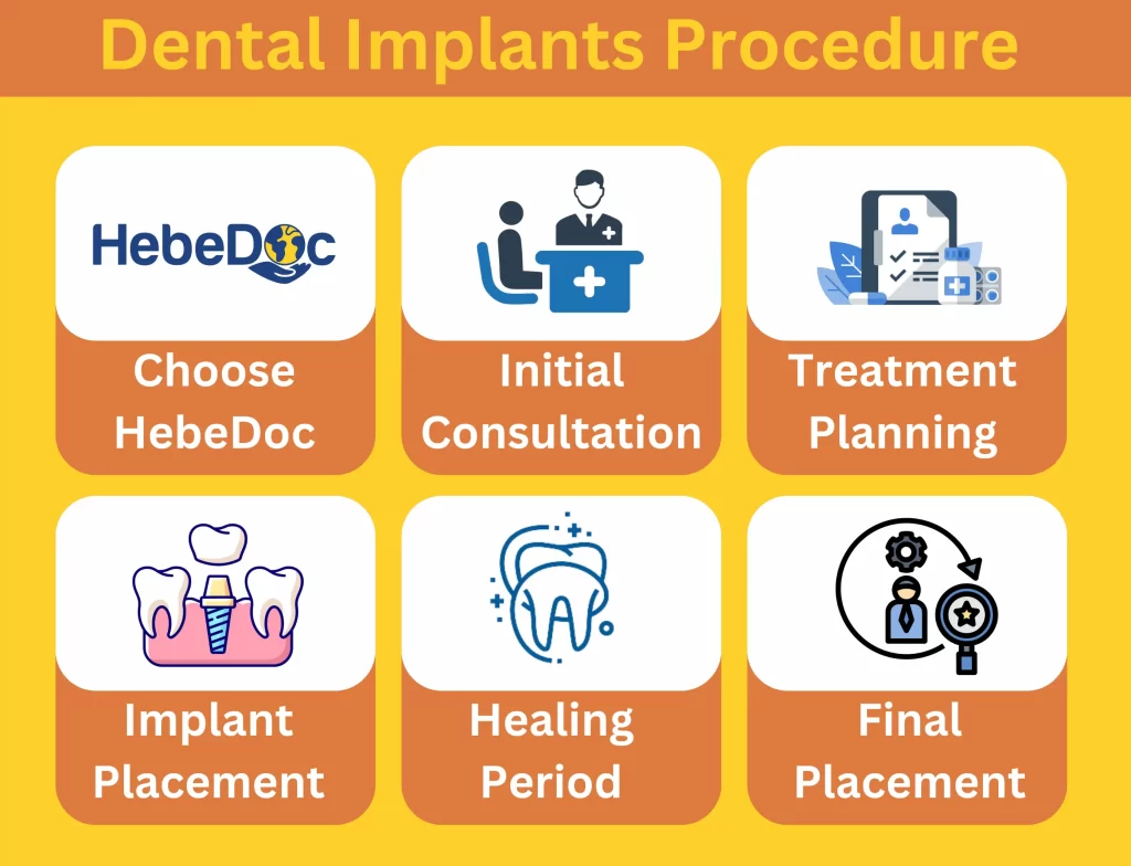 dental implant procedure in Mexico for US