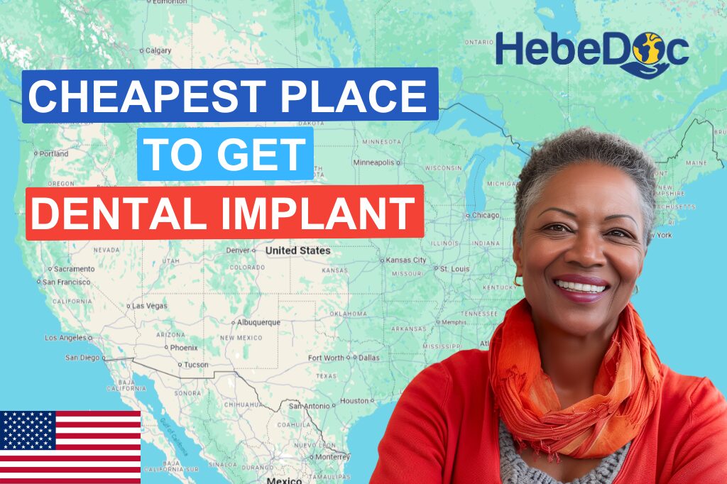 Cheapest Dental Implant in USA