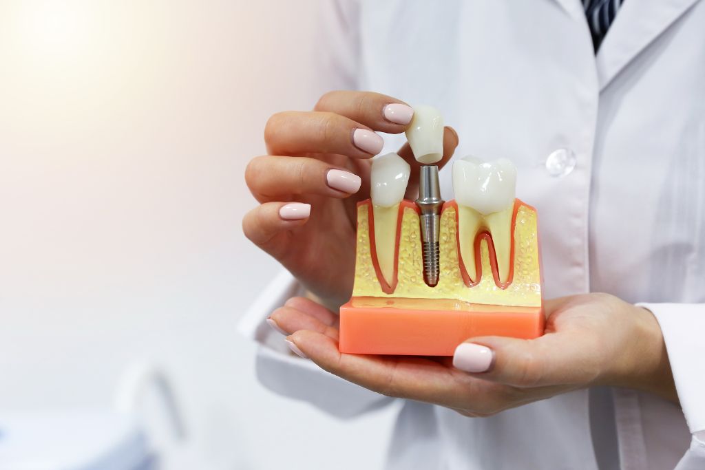 Cheapest Country for All-on-4 Dental Implants