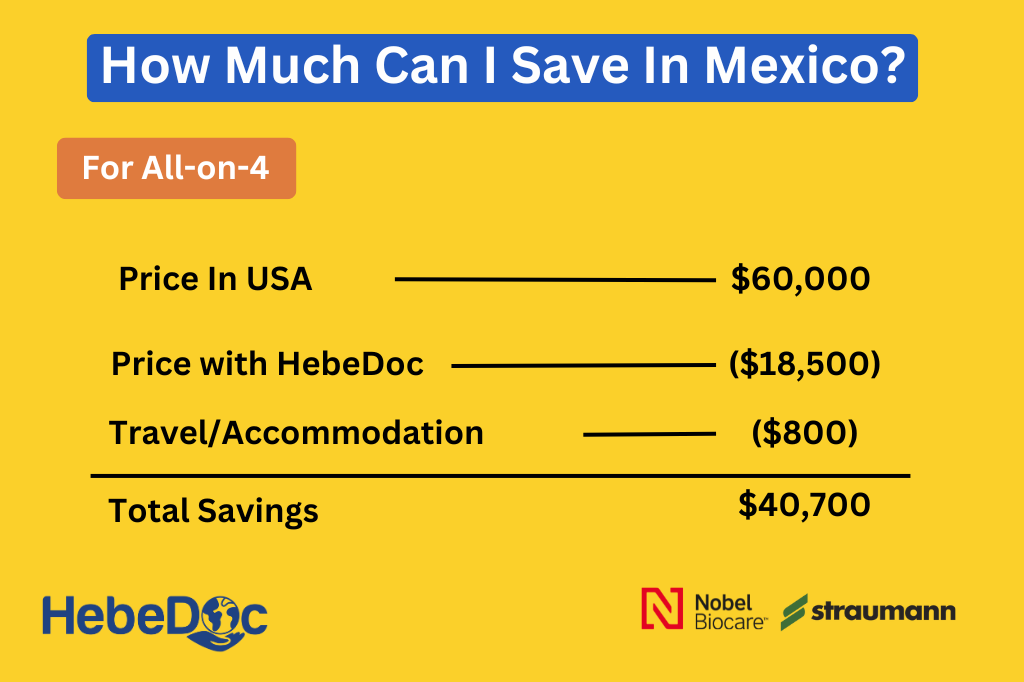 How-Much-Can-I-Save-In-Mexico-for-dental-Implants